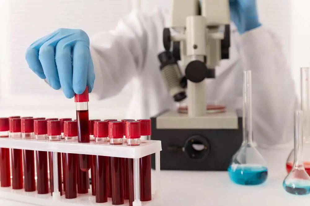 BRCA test